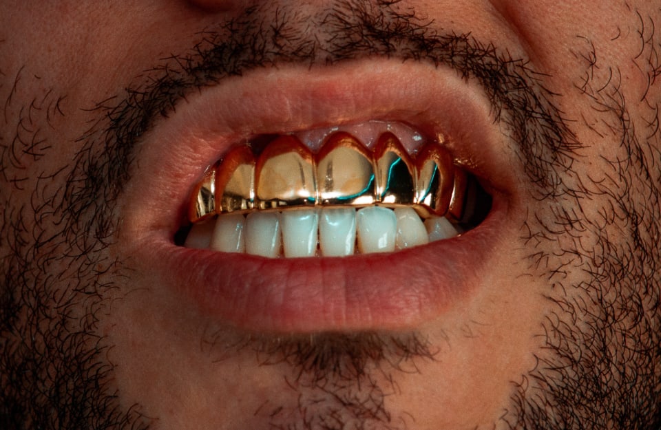 Primo piano sulla bocca di un uomo con la barba e i denti superiori ricoperti d'oro